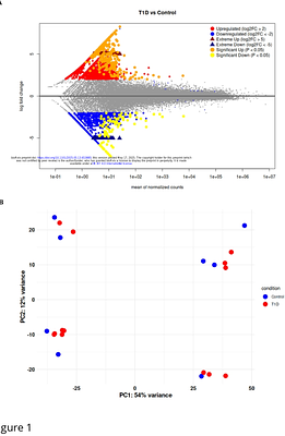 A novel bioinformatics approach reveals key transcription factors regulating type 1 diabetes-associated transcriptomes