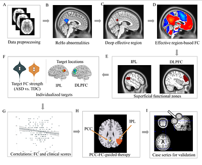 Individualized Functional Connectivity-Guided TMS Targeting Theory of Mind Network for Autism Spectrum Disorder
