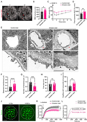 Diet-induced obesity results in endothelial cell desensitization to VEGF-A and permanent islet vascular dysfunction