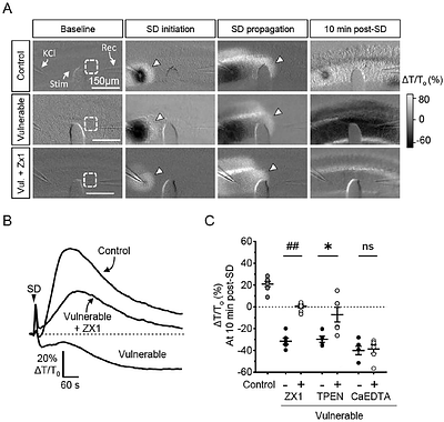 Synaptic Zn2+ contributes to deleterious consequences of spreading depolarizations