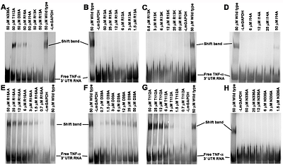 Mapping of residues in leishmanial glyceraldehyde-3-phosphate dehydrogenase crucial for binding with 3'-UTR of TNF-alpha mRNA