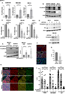 Metabolic maintenance of breast cancer cells and metastases throughE-cadherin/YAP-dependent pyruvate carboxylase expression