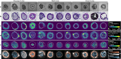 Revealing Spatial Heterogeneity across the Gut Tissue-Lumen Interface through MALDI Mass Spectrometry Imaging