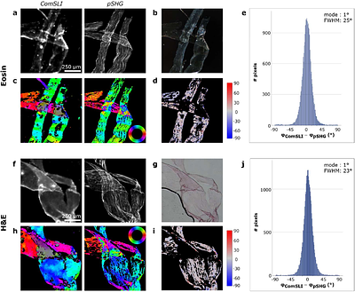 Collagen fibre organisation revealed with computational scattered light imaging and polarimetric second harmonic generation microscopy
