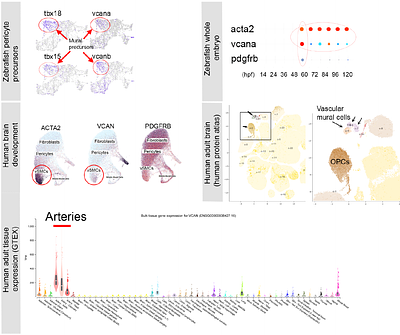 Characterization of variants associated with Cerebral Small Vessel Disease identifies a functional SNV in Versican