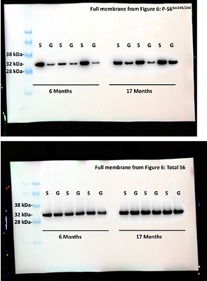 Glucagon receptor signaling is indispensable for the healthspan effects of caloric restriction in aging male mice