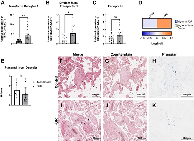 Placental Iron Utilisation in Fetal Growth Restriction: Alterations in Mitochondrial Heme Synthesis and Iron-Sulfur Cluster Assembly Pathways