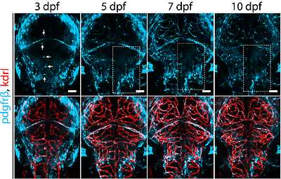Progressive mural cell deficiencies across the lifespan in a foxf2 model of Cerebral Small Vessel Disease