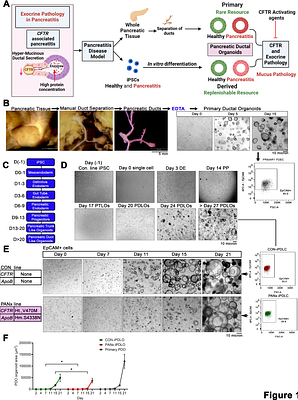 Differential Expression and Microsystem Physiology Reveal Predominant and Drug Reversible CFTR-Related Defects in Idiopathic Pancreatitis