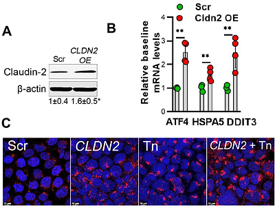 Autophagy prevents ER stress-induced Tight Junction barrier disruption via claudin-2 homeostasis