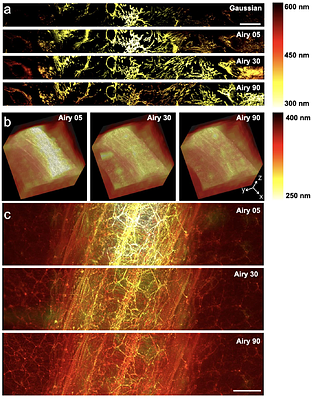 Observing concurrent subcellular dynamics in large living tissues