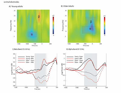 Age-Related Changes in the Neural Dynamics of Speech Production Following Noninvasive Brain Stimulation