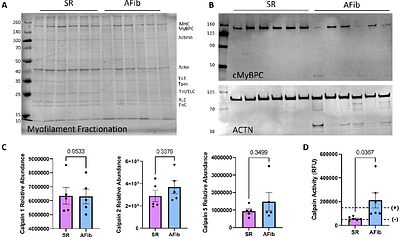 Proteolytic degradation of atrial sarcomere proteins underlies contractile defects in atrial fibrillation