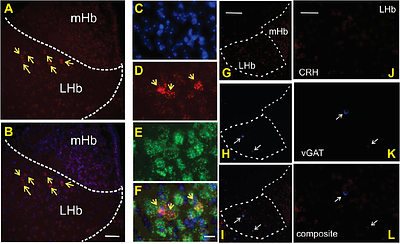 Neuroanatomical and behavioral characterization of corticotropin releasing factor-expressing lateral Habenula neurons in mice