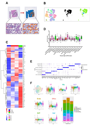 Spatial analysis of Hofbauer cell transcriptome, distribution and morphology in placentas exposed to Plasmodium falciparum