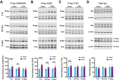 PP2A METHYLESTERASE, PME-1, AND PP2A METHYLTRANSFERASE, LCMT-1, CONTROL SENSITIVITY TO IMPAIRMENTS CAUSED BY INJURY-RELATED OLIGOMERIC TAU