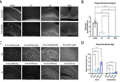 Plaque-associated Microglial Polarization in Visual Brain Regions of the 5xFAD Mouse Model