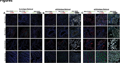Exploring Spike-Dependent and ACE2-Independent Viral Entry into Salivary Epithelial Cells in the Absence of ACE2