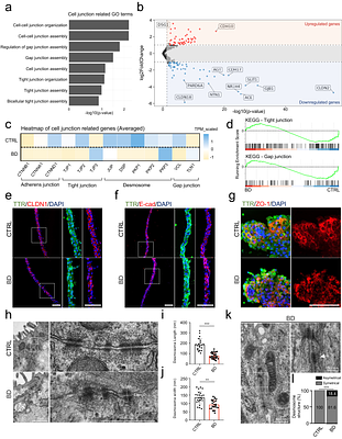 Dysregulation of Hippo Signaling Pathway as a Convergent Mechanism Underlying Choroid Plexus Defects in Bipolar Disorder