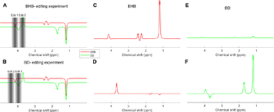 Challenges and Solutions in Quantifying Brain β-Hydroxybutyrate (BHB) with 1H-MRS Following Oral Keto-Ester Consumption