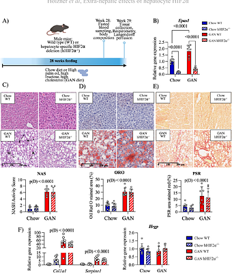 Hepatic HIF2α modulates extra-hepatic disease-associated phenotypes during metabolic dysfunction-associated steatotic liver disease