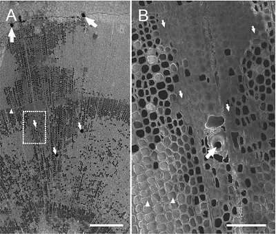 Resin canal leakage underlying xylem dysfunction in pine wilt disease