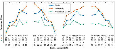 TLNM: Externally Validated Tooth Detection, Numbering and Segmentation from Smartphone Photographs Using Mask R-CNN