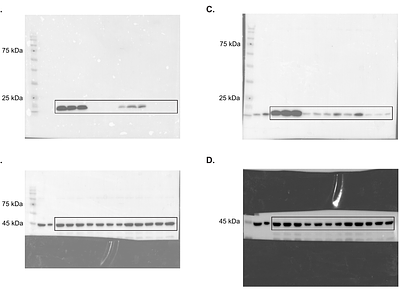 A Kidney Stone Associated CLDN4 Variant Impairs Tight Junction Stability and Paracellular Ion Permeability
