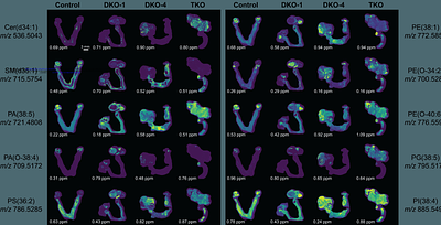 Ultrahigh Resolution Lipid Mass Spectrometry Imaging of High-Grade Serous Ovarian Cancer Mouse Models