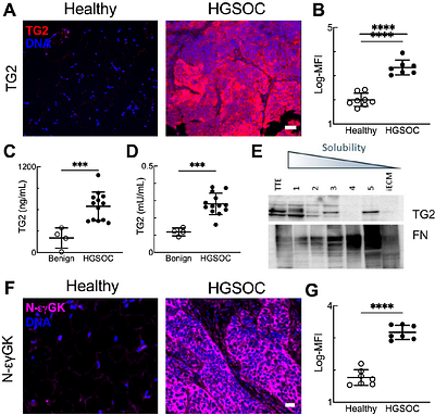 Fibronectin Composition and Transglutaminase 2 Cross-linking Cooperatively Regulate Ovarian Cancer Cell Adhesion in ECM-Mimetic Constructs