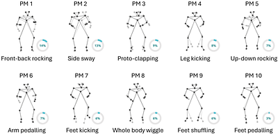 Development of Auditory and Spontaneous Movement Responses to Music over the First Year of Life