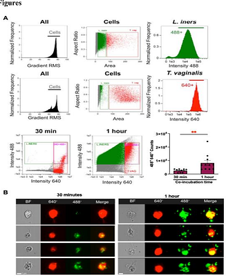 Study of microbe-microbe interactions between the sexually transmitted parasite Trichomonas vaginalis  with the cervicovaginal bacteria Lactobacillus iners