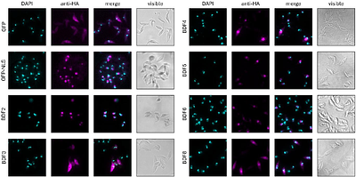 Structural Insights into Bromodomain-Containing Complexes from Trypanosoma cruzi Revealed by Proximity Labeling and Stoichiometric Space Exploration