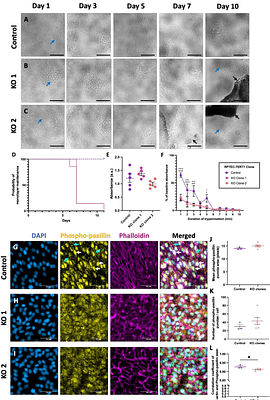 Mechanobiological proximal tubular defects in ARC syndrome: A VPS33B CRISPR knockout study