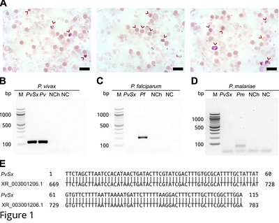 The reticulocyte restriction: invasion ligand RBP1a of Plasmodium vivax targets human TfR1, prohibitin-2, and basigin