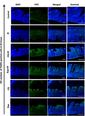 Targeting Autophagy Accelerates Intestinal Repair after Acute Ionizing Radiation