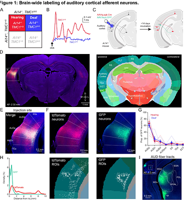 Brain-wide mapping of neuroanatomical connections to the auditory cortex of hearing and deaf mice