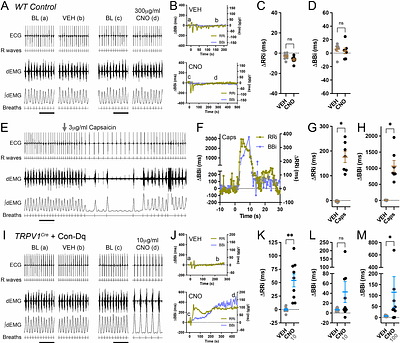 Anatomical and functional mapping of vagal nociceptive sensory nerve subsets innervating the mouse lower airways by intersectional genetics