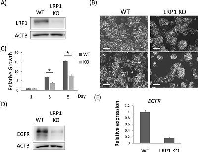 FUT8 mediated core fucosylation modulates growth related functions of LRP1 in liver cancer cells
