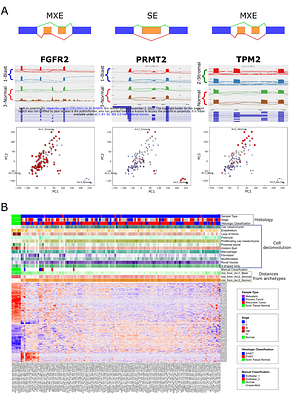Characterization of alternative splicing in high-risk Wilms tumors