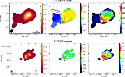 The link between galaxy merger, radio jet expansion and molecular
  outflow in the ULIRG IRAS 00183-7111