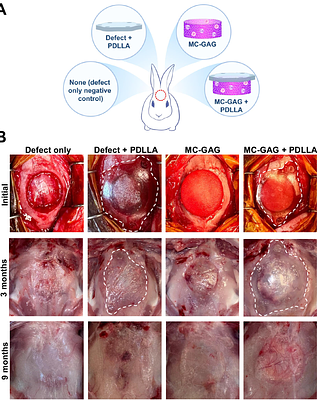 Resorbable Poly-(D,L)-Lactide Anchorage of Nanoparticulate Mineralized Collagen Materials Maximizes In Vivo Skull Regeneration