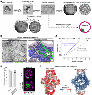 In situ cryo-ET of mammalian embryos reveals cytoplasmic lattices contain ubiquitin-charged E2-E3 ligase assemblies