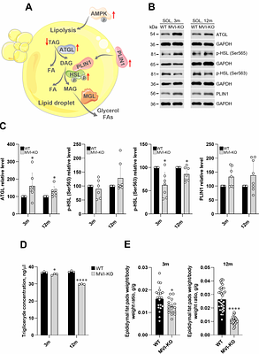 Unconventional myosin VI is involved in the regulation of muscle energy metabolism