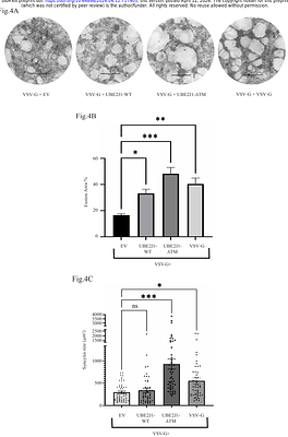 Phosphorylation of UBE2J1 at serine residue S184 contributes towards infection and cellular syncytialization by Vesicular Stomatitis Virus