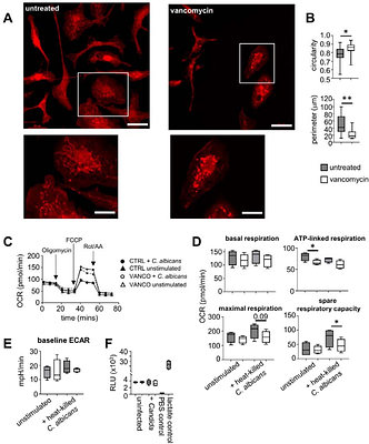 Vancomycin impairs macrophage fungal killing by disrupting mitochondrial morphology and function