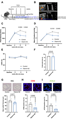 Vitamin K2 Limits Ferroptosis-Associated Lipid Peroxidation and Attenuates Aortic Valve Stenosis