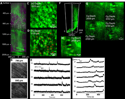 Three photon microscopy of mouse brain structure and function at 2 mm depth and beyond