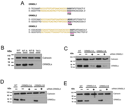 The individual isoforms of ORMDL, the regulatory subunit of serine palmitoyltransferase, have distinctive sensitivities to ceramide.
