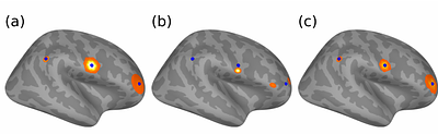 Localization of Spatially Extended Brain Sources by Flexible Alternating Projections (FLEX-AP)